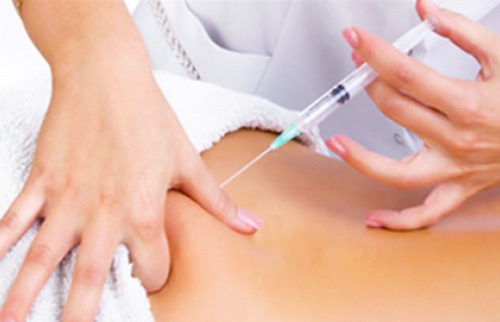 eliminar grasa corporal con mesoterapia donostia